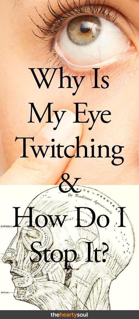 Sometimes your eye can twitch and you may not even notice. Stress and fatigue play as a large contributor to this. Here are 7 causes for eye twitches and possible relief remedies. #twitch, #eye, #stress, #fatigue Right Eye Twitching, Stop Eye Twitching, Eye Twitch, Nail Remedies, Eye Twitching, Blurry Vision, Neurological Disorders, Traditional Medicine, Dry Eyes