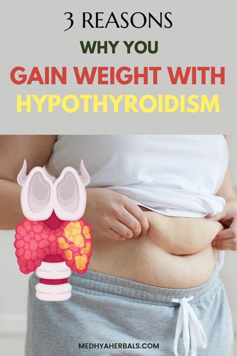 Can Hypothyroidism cause weight gain? The relation between Hypothyroidism weight gain and your Metabolism. Learn here Ayurvedic natural tips to lose weight with hypothyroidism. Start today! Herbs To Burn, Thyroid Diet Plan, Ayurvedic Tips, Thyroid Surgery, Thyroid Symptoms, Hashimotos Disease, Thyroid Medication, Thyroid Health, Help Losing Weight