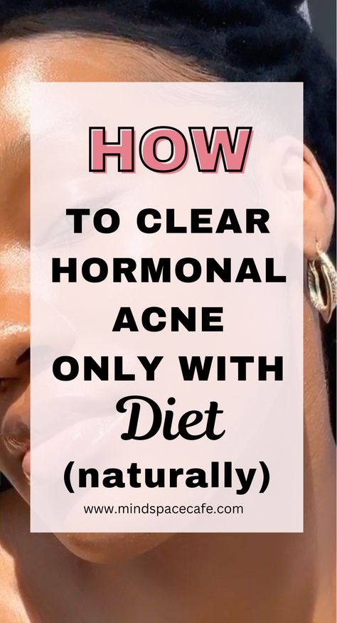 5 Foods that Cleared my Hormonal Cystic Acne for Good (Hormonal Acne Diet) - Mind Space Cafe Things To Help Hormonal Acne, Cystic Hormonal Acne, Treating Hormonal Acne, Hormonal Chin Acne, Acne Safe Breakfast, How To Treat Hormonal Acne, Foods That Help With Acne, How To Get Rid Of Hormonal Acne, Face Treatments For Acne