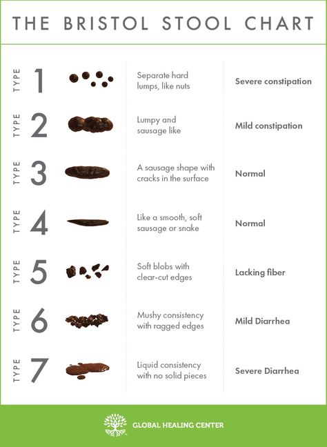 Bristol Stool Chart Bristol Stool, Bristol Stool Chart, Stool Chart, Chronic Constipation, Healthy Morning Routine, Healthy Bacteria, Eating Organic, Good Foods To Eat, Colon Cleanse