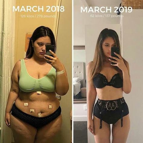 Ariana Omipi, Trx Workouts, After Pictures, Before And After Pictures, Fitness Transformation, Stubborn Belly Fat, Body Building, How To Slim Down, Lose Belly