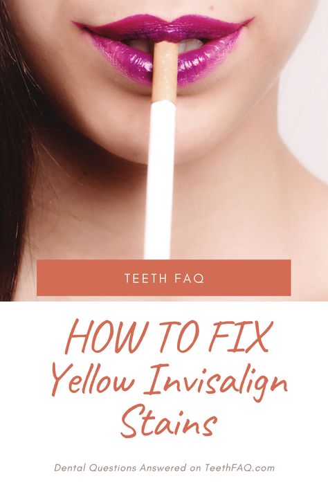 What to do to fix yellow Invisalign stain - top tips and tricks! Invisalign Tips And Tricks, Remove Yellow Stains, Invisalign Aligners, Invisible Braces, Yellow Teeth, Nice Teeth, The Teeth, Healthy Smile, What Can I Do