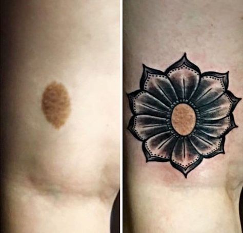 Genius Tattoos That Work Well With Birthmarks Birthmark Tattoo, Independent Tattoo, Sunflower Tattoo Thigh, Sunflower Tattoo Sleeve, Sunflower Tattoo Shoulder, Tattoos To Cover Scars, Gorgeous Tattoos, Flower Tattoo Sleeve, Tattoo Cover