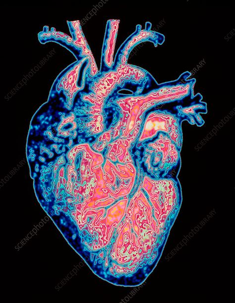 Pulse Aesthetic, Heart Scan, Anatomy Embroidery, Aortic Arch, Cool Screensavers, Heart Arteries, Heart Flow, Medical Images, Blood Heart