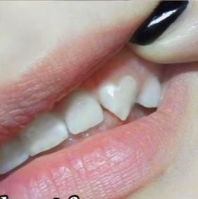 Heart Fangs, Teeth Aesthetic, Vampire Teeth, Teeth Shape, Beautiful Tiaras, Body Mods, Art Reference Photos, Aesthetic Fashion, Aesthetic Pictures