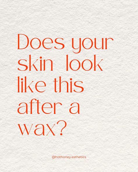 If your skin looks like this after a wax, it’s OK You guys…skin is weird! If you’ve experienced these skin reactions, it’s totally normal and totally something good pre and post wax home care can help to reduce. Some good tips to follow: - limit caffeine & alcohol the day of your appointment - Benadryl or an anti-histamine helps if you’re prone to histamine reactions - Shower on the day of your appointment - Follow all home care recommendations from your esti Hot Honey Esthetics 📍Ma... Wax Appointment, Alter Decor, Hot Honey, Are You Ok, Body Skin, Body Skin Care, Home Care, Your Skin, Honey