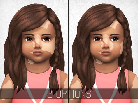 Unique Birthmarks, Sims 4 Skintones, The Sims 4 Kids, Toddler Cc Sims 4, Sims Baby, Code Roblox, The Sims 4 Skin, Sims 4 Cc Kids Clothing, The Sims 4 Pc