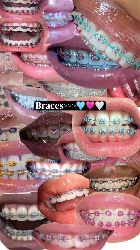 Perfect Teeth Braces, Braces Colours, Teeth Aesthetic, Cute Braces Colors, Pretty Teeth, Braces Tips, Getting Braces, Cute Braces, Brace Face