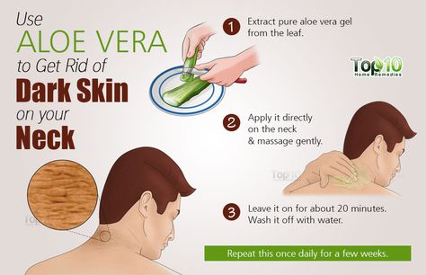 aloe vera for dark skin on your neck                                                                                                                                                                                 More Dark Patches On Skin, Aloe Vera Acne, Dark Neck, Aloe Vera Moisturizer, Vaseline Beauty Tips, Aloe Vera Hair, Throbbing Headache, Aloe Vera Skin, Aloe Vera Face