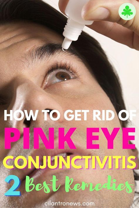 You will find how to get rid of viral, bacterial, fungal, parasitic and allergic pink eye (conjunctivitis) naturally and fast in this article. Diy Eye Drops, Pink Eye Home Remedies, Natural Pink Eye Remedy, Eye Health Remedies, Eye Medicine, Puffy Eyes Remedy, Pinkeye Remedies, Natural Remedies For Migraines, Eye Infections