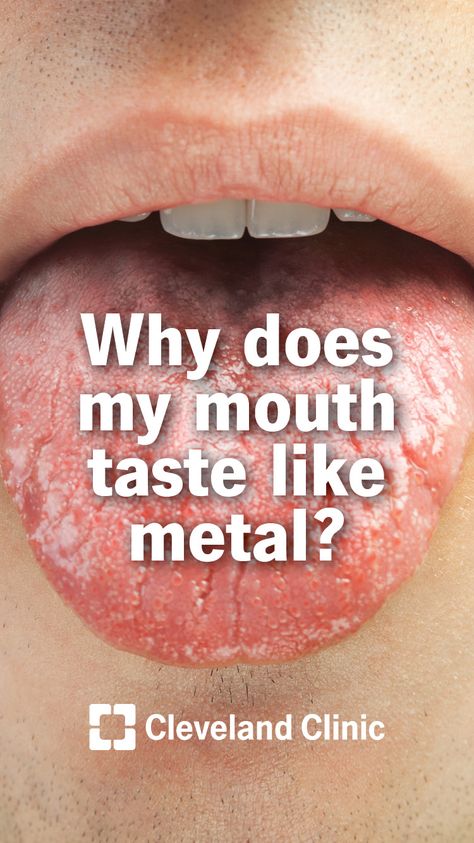 Metallic Taste In Mouth, Remedies For Dry Mouth, Natural Teeth Whitening Diy, Strong Teeth, Teeth Whitening Diy, Teeth Health, Oral Care Routine, Gum Care, Natural Teeth Whitening