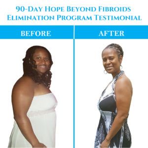 Fibroid Diet, Fibroid Uterus, Fibroid Surgery, Fibroid Tumors, Polycystic Ovarian Syndrome, Medical School Essentials, Naturopathic Doctor, Natural Treatments, Body Health