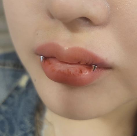 Angel Bites Piercing, Angel Bites, Upper Lip Piercing, Snake Bite Piercing, Vertical Labret Piercing, Mouth Piercings, Vertical Labret, Nail Piercing, Face Piercings