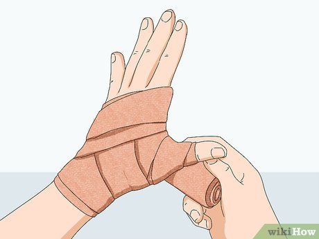 How To Wrap A Sprained Thumb, Sprained Thumb, Athletic Training Sports Medicine, Thumb Sprain, Hand Therapy Exercises, Sprained Wrist, Reduce Bruising, Thumb Splint, Sore Hands