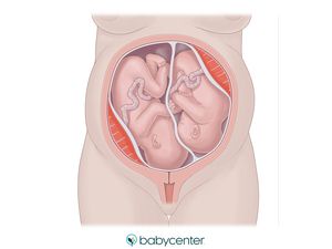 36 Weeks Pregnant Symptoms, Twins In The Womb, Last Week Of Pregnancy, Prenatal Development, Breech Babies, 24 Weeks Pregnant, Birth Videos, Pregnant With Twins, 36 Weeks Pregnant