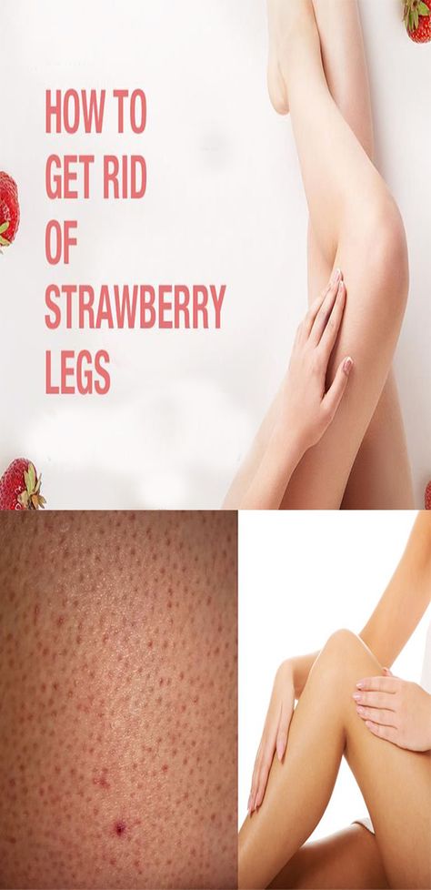 Strawberry Hands Remedy, Aesthetic Hygiene, Natural Face Masks, Legs At Home, Foot Care Tips, Strawberry Legs, Hand And Foot Care, Nails Healthy, Natural Face Mask