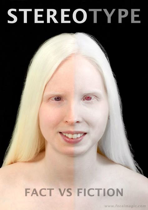 People With Purple Eyes, Albino People, Albino Model, Albino Girl, You Are So Beautiful To Me, Violet Eyes, Body Reference Poses, Light Eyes, Body Reference