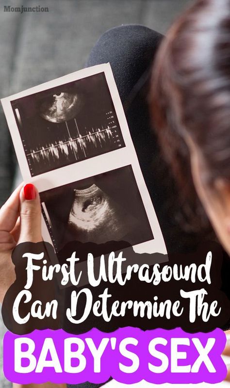 Baby Heart Rate Gender, Ultrasound Boy Or Girl, 8 Weeks Pregnant Ultrasound, Boy Ultrasound Pictures, Baby Gender Ultrasound, Ultrasound Gender Prediction, Boy Or Girl Prediction, Boy Ultrasound, Pregnancy Gender Prediction