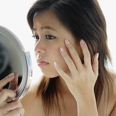 When do personality quirks cross the line into obsessive-compulsive disorder? These 10 common symptoms may be a sign of OCD. Razor Bump, Acne Overnight, Natural Acne Remedies, Home Remedies For Acne, How To Get Rid Of Pimples, Acne Causes, Acne Scar Removal, Skin Disorders, Skin Secrets