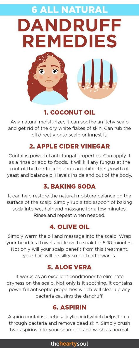 beauty glazed gorgeous me Natural Dandruff Remedy, Dandruff Remedy, Scalp Treatments, Natural Healing Remedies, Stop Trying, Itchy Scalp, Natural Therapy, Natural Moisturizer, Dry Scalp