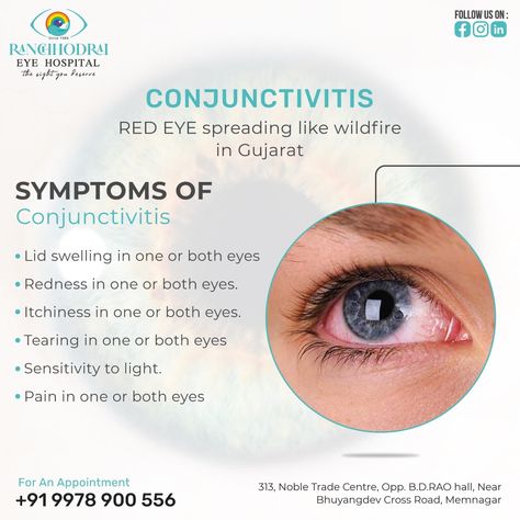 Conjunctivitis can be caused by various factors, including viral or bacterial infections, allergens, irritants, or other underlying health conditions. To know more about the symptoms, contact #eyehospitalnearme Ranchhodrai Eye Hospital. visit us - https://www.ranchhodraieyehospital.com/contact-us #ranchhodraieyehospital #eyehopsital #surgery #eyesurgery #conjunctivitis #eye #ophthalmology #eyehealth #glaucoma #pinkeye #eyedoctor Hospital Visit, Eye Hospital, Pink Eye, Eye Surgery, Bacterial Infection, Eye Doctor, Pink Eyes, Eye Health, Health Conditions