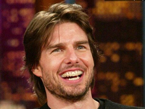 Celebrities in braces: Mr. Mission Imposible himself #BracesForEveryone www.360orthodontics.com Tom Cruise Teeth, Celebrities With Braces, Tom Cruise Smile, Weird Smile, Adult Braces, Dental Implant Procedure, Traditional Braces, Clear Braces, Suri Cruise