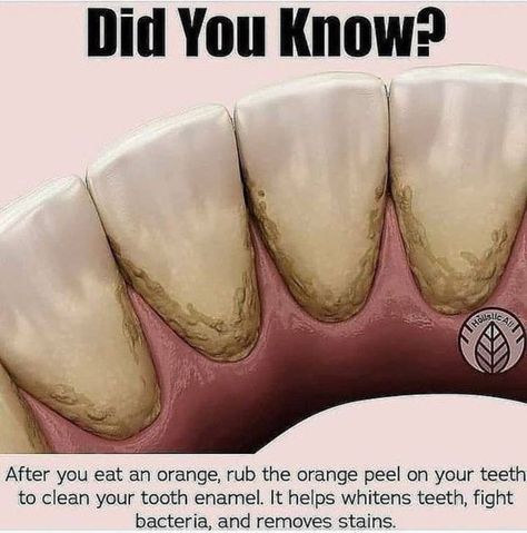 Orange Stuff, Healthy Facts, Healthy Herbs, Teeth Health, Home Health Remedies, Natural Health Tips, Teeth Care, Health Knowledge, Good Health Tips