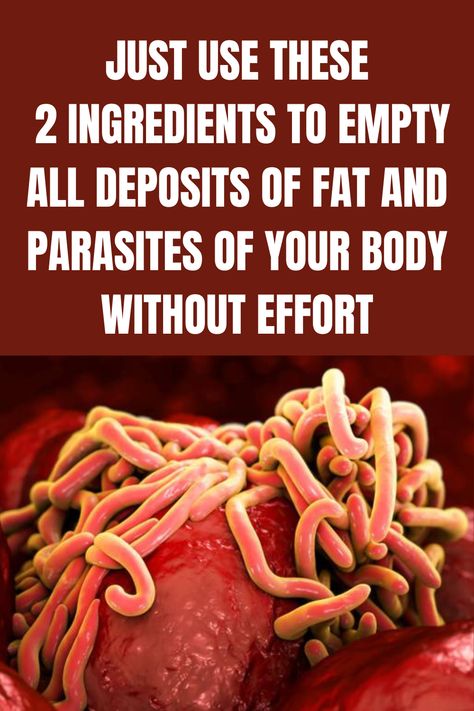 Foods That Kill Parasites, How To Get Rid Of Parasites In Humans, Dried Cloves, Skin Parasites, Parasite Cleanse, Strict Diet, Alternative Health, Natural Home Remedies, Health And Beauty Tips