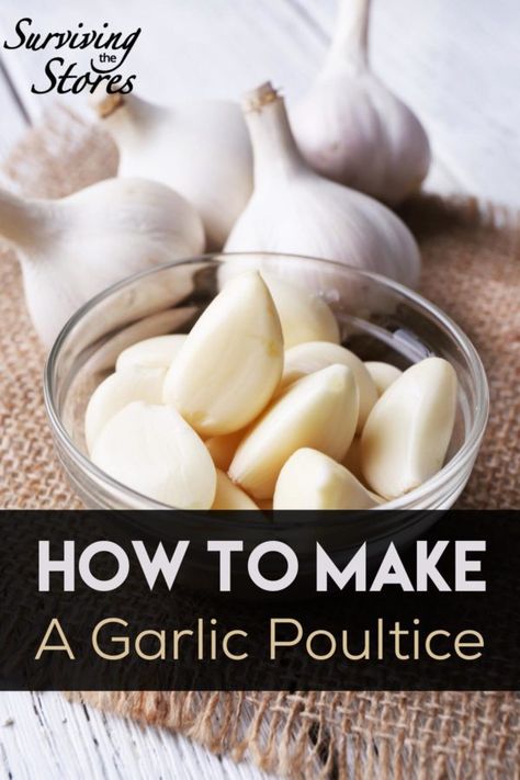 How To Make A Garlic Poultice - Surviving The Stores™ Garlic