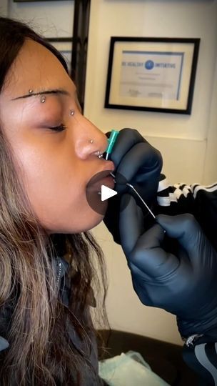 Classy Piercing Ideas, Medusa And Labret Piercing, Madusa Piercing, Medusa Piercing On Black Women, Small Medusa Piercing, Medusa Piercing Aesthetic, Face Piercings Women, Facial Dermal Piercing, Piercing Medusa