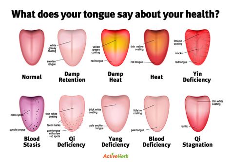 Chinese Medicine Diet, Tcm Traditional Chinese Medicine, Health Chart, Eastern Medicine, Tongue Health, Chinese Herbs, Traditional Chinese Medicine, Reflexology, Health Info