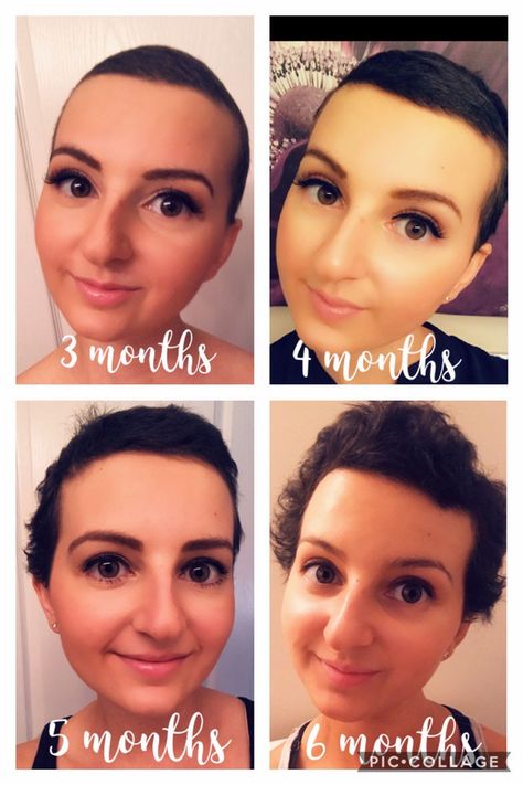 Let it Grow: Tips for Post-Chemo Hair Growth! Growing Hair After Chemo, Hair Growth Post Chemo, Chemo Curls, Hair Growth After Chemo, Growing Out Hair, Chemo Care, Let It Grow, Chemo Hair, Help Hair Grow