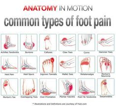 Foot Pain Chart, K Tape, Foot Exercises, Back Pain Remedies, Ankle Pain, Foot Pain Relief, Preventative Health, Hip Pain, Heel Pain