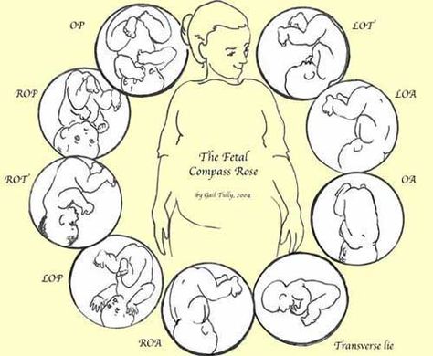 The Fetal Position Rose by Gail Tully (me) shows eight head down baby positions and a sideways baby in what's called a "transverse lie." Anterior Placenta, Cervical Dilation, Spinning Babies, Student Midwife, Fetal Position, Pregnancy Labor, Childbirth Education, Birth Doula, Mommy Workout