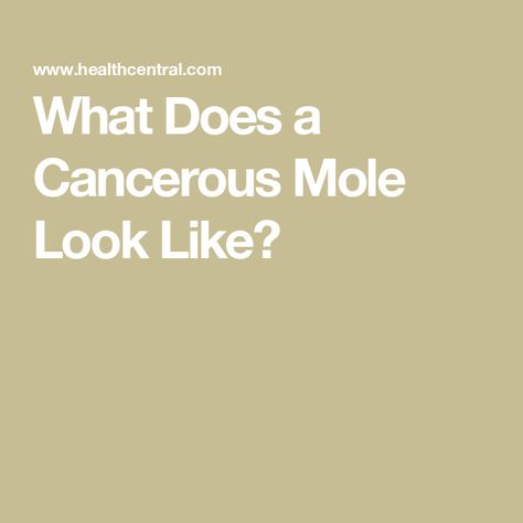 What Does a Cancerous Mole Look Like? Mole Above Lip, Cancerous Moles, Dark Mole, Moles On Face, Burn Arm Fat, Arm Fat, George Washington University, Genetic Testing, Types Of Cancers