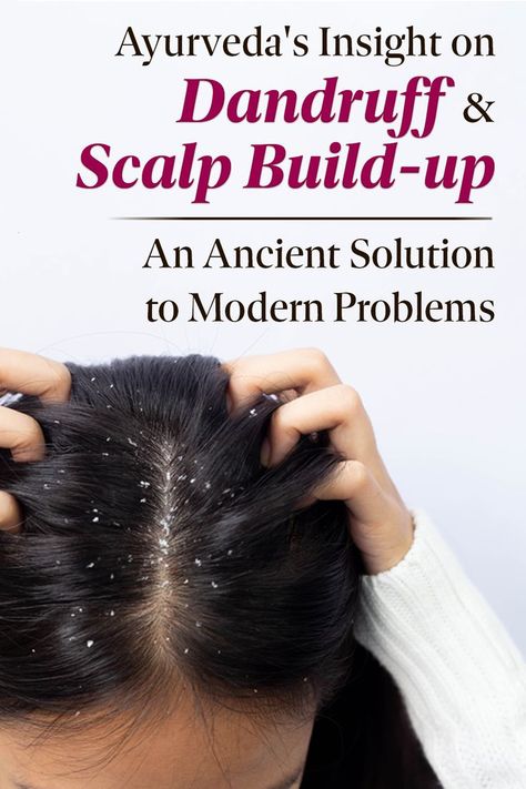 Struggling with dandruff and scalp build-up? Well, this can be a problematic situation, especially in hot & dry summers and humid conditions but Ayurveda has solution. Glowing Skin Home Remedies, Fleas Home Remedies, Home Remedies For Sore Throat, Home Remedies For Fleas, Home Remedies For Glowing Skin, Cough Home Remedies, Natural Dandruff Remedy, Hair Growth Methods, Dandruff Solutions