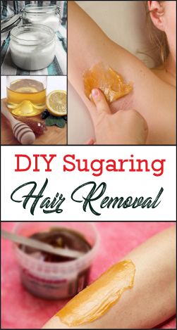 Sugaring Recipe, Sugaring Hair Removal Diy, Body Sugaring, Chin Hair Removal, Leg Hair Removal, Electrolysis Hair Removal, Sugaring Hair Removal, Hair Removal Diy, Unwanted Hair Permanently