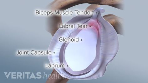 5 Labrum Tear Symptoms You Need to Know Slap Tear Shoulder, Frozen Shoulder Exercises, Shoulder Flexibility, Sports Physical Therapy, Shoulder Problem, Shoulder Injury, Bicep Muscle, Shoulder Surgery, Frozen Shoulder