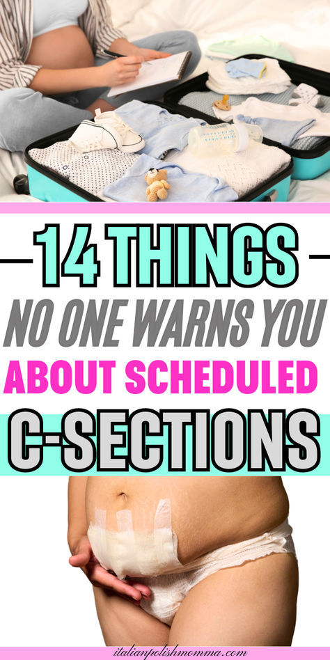 What to expect for a c-section, 14 things to know before a scheduled cesarean section, preparing for a c-section birth 1 Week Post Partum Belly, Csection Hospital Bag List, Preparing For C Section, Cesarian Section Recovery, C Section Scar Healing, C Section Pictures, C Section Outfit, C Section Post Partum Essentials, Post Partum C Section