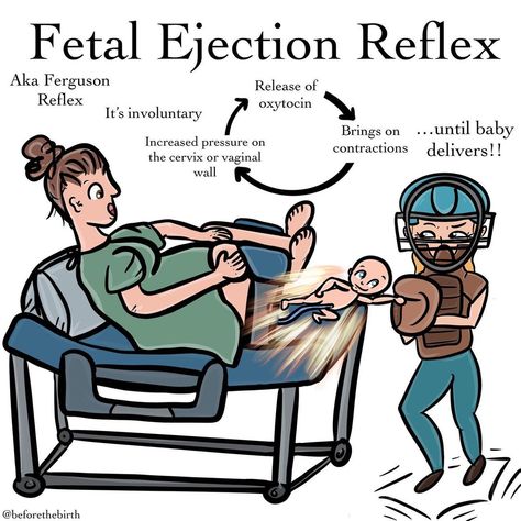 Christie | Childbirth Educator on Instagram: “Fetal Ejection Reflex😱 Also known as the Ferguson Reflex!💫 Quick facts about this reflex: - ✔️it’s involuntary - ✔️It’s known as a…” Nursing Instructor, Doula Training, Natural Labour, Brother Birthday Quotes, Baby Delivery, Fertility Awareness, Childbirth Education, Fetal Development, Birth Doula