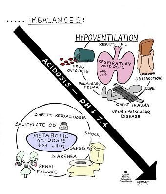 Hypoventilation Nursing Information, Nursing Mnemonics, Nursing School Survival, Respiratory Therapy, Nurse Rock, Acid Base, Nursing School Studying, Nursing School Tips, Nursing School Notes