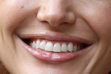 do you know your Celebrity Smiles - Gallery Guess The Celebrity, V34 Colour Corrector, Celebrity Smiles, Smile Day, Colour Corrector, World Smile Day, Custom Grill, Mom Beauty, Whitening Teeth