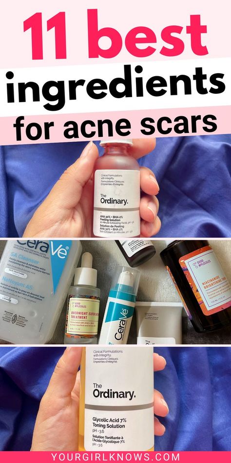 Want to know how to heal acne scars? You better have a darn good skincare routine with these ingredients in any of your products. These will save your skin and you'll thank me later! | acne scar mask, acne scar removal, products for acne scars, acne scars skin care routine, how to clear acne scars, how to help acne scars, how to fix acne scars, ingredients for acne scars | Fix Acne, Scar Mask, Ingredients For Acne, Night Face Mask, Leg Scars, Best Acne Scar Removal, Makeup Acne, Acne Scar Removal Cream, Acne Scar Mask