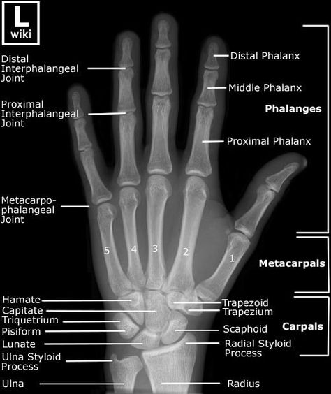 Embedded Radiology Schools, Medical Radiography, Radiology Student, Radiology Technician, Radiology Imaging, Medical School Studying, Medical Imaging, Medical Anatomy, Medical Coding