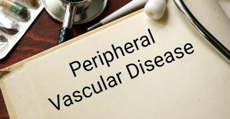 Peripheral vascular disease (PVD) is a circulation disorder that occurs when the arteries and veins narrow and restrict blood flow. Arteries And Veins, Health And Beauty Tips, Blood Flow, Beauty Tips, Disease, Health And Beauty, Health, Beauty