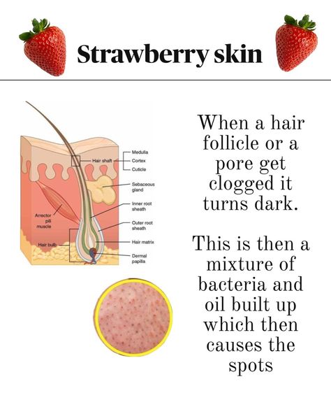 Yesterday while taking to you There was a bunch of questions regarding this so this is a post for you to Save❣️ Also, dark armpits, gua sha routine, chest acne and Chemical peels Are coming I always read all of your messages and then make a post about it❤️ #skin #strawberrylegs #shaving #exfoliating #laserhairremoval #smoothskin Gua Sha Routine, Chest Acne, Matrix Hair, Strawberry Legs, Dark Armpits, Chemical Peels, Chemical Peel, Gua Sha, Hair Follicle