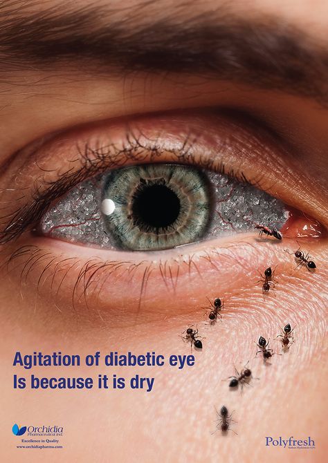 Interesting to see this eye drop ad- Rohto inspo Eye Campaign Poster, Eye Poster Design, Eye Creative Ads, Eye Hospital Creative Ads, Eye Advertising, Advertising Campaign Design, Healthcare Ads, Healthcare Advertising, Eye Poster