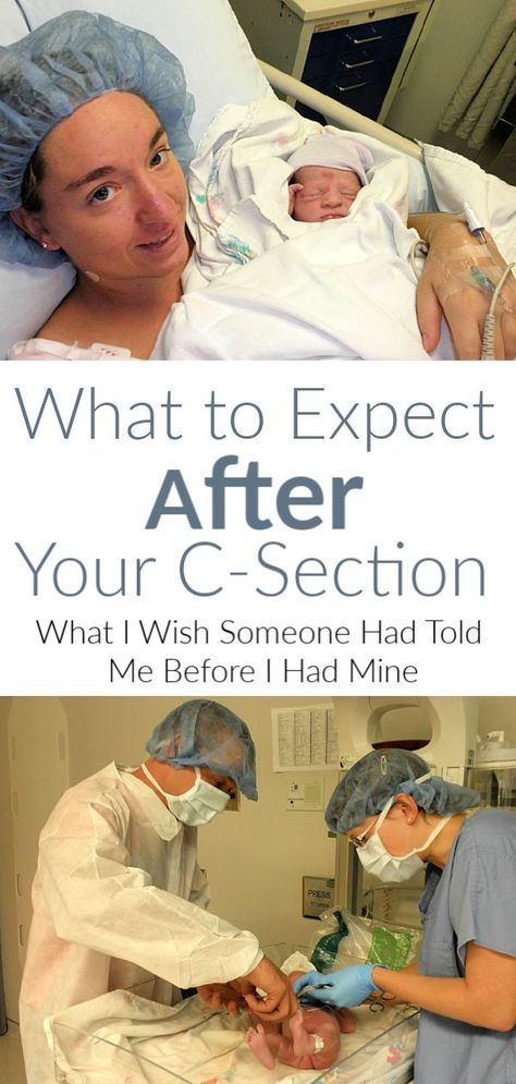 What to Expect After a C-Section C Section Photos, C Section Pictures, C Section Photography, C Section Tips, C Section Recovery Essentials, Hospital Pictures Newborn, C Section Recovery Timeline, Breastfeeding After C Section, C Section Belly