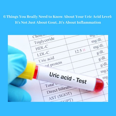 Low Uric Acid Diet, Uric Acid Remedy, Uric Acid Symptoms, Uric Acid Food, Uric Acid Diet, Purine Diet, Uric Acid Crystals, Uric Acid Levels, Increase Blood Pressure