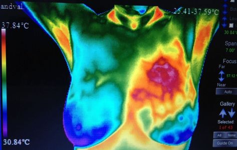 Oprah’s buddy Dr. Christiane Northrup and breast thermography: The opportunistic promotion of quackery Funny Headlines, Complex Regional Pain Syndrome, Heat Map, Arte 8 Bits, Health Heal, Thermal Imaging, Medical News, Good Morning America, Aesthetic Images